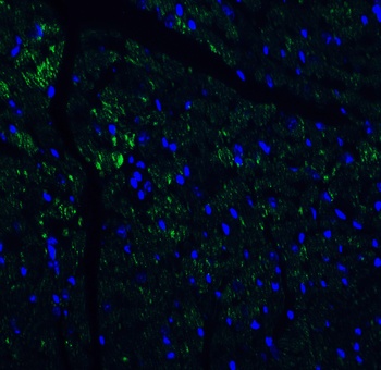 IL-17 Antibody