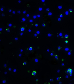 IL-17 Antibody