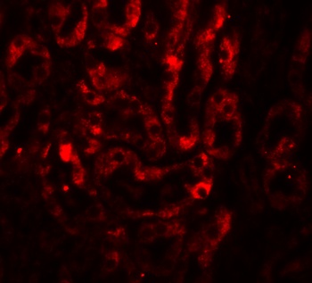 IL-17 Antibody