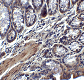 IL-17 Antibody