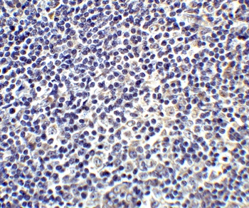IL-17 Antibody