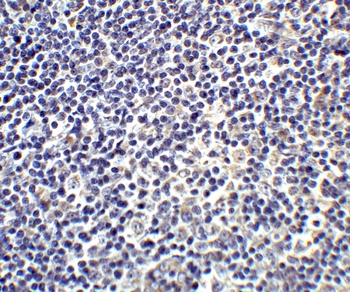 IL17A Antibody