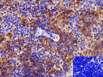 IL-21 Antibody
