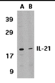 IL21 Antibody