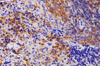 IL-21 Antibody