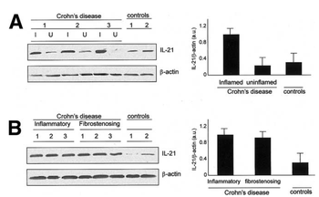 IL-21 Antibody