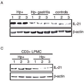 IL-21 Antibody