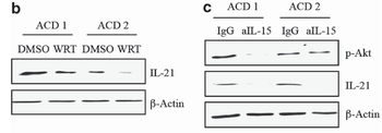 IL-21 Antibody