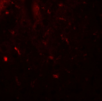 MALT1 Antibody