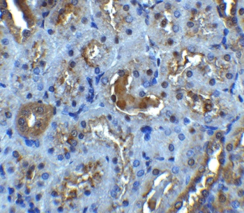 IL22RA1 Antibody
