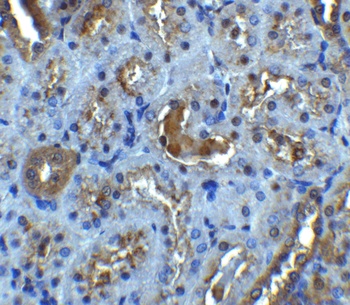 IL-22 Receptor Antibody