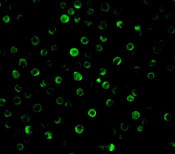 IL22RA1 Antibody