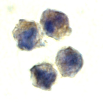 IL-22 Receptor Antibody