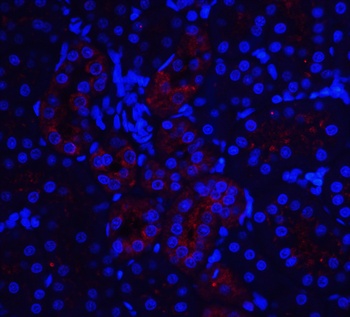 IL-22 Receptor Antibody