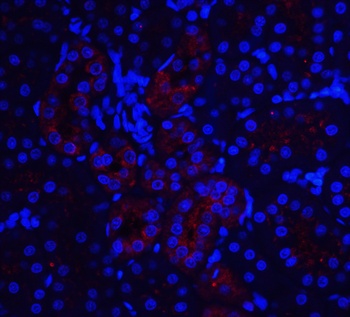 IL22RA1 Antibody