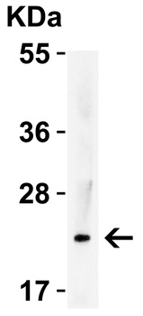 IL23A Antibody