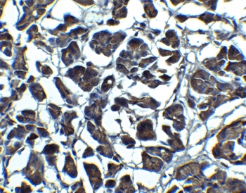 IL23A Antibody