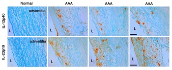 IL23A Antibody