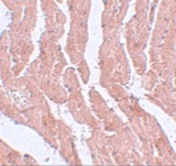 LZTR1 Antibody