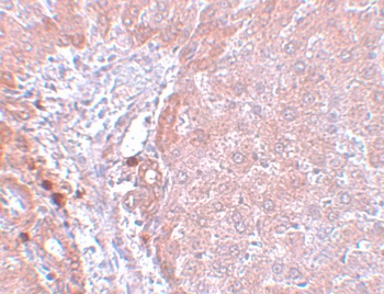 NDUFB9 Antibody