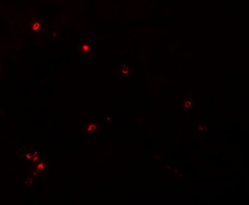 NDUFB9 Antibody
