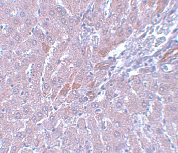 LYRM1 Antibody