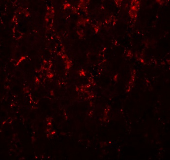 LXR-A Antibody