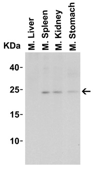 IL23A Antibody