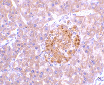 IL23A Antibody