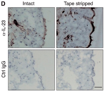 IL23A Antibody