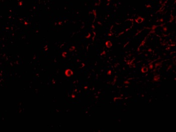 IL-32 Antibody