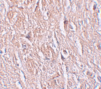 LRRTM4 Antibody