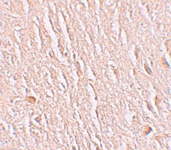 LRRTM3 Antibody