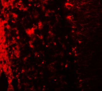 LRRTM2 Antibody