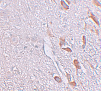 LRRTM1 Antibody