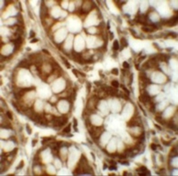 LRRFIP2 Antibody