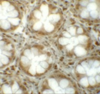 LRRFIP1 Antibody