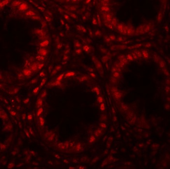 LRRFIP1 Antibody