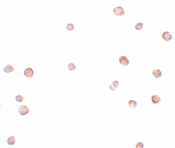 LRRC19 Antibody