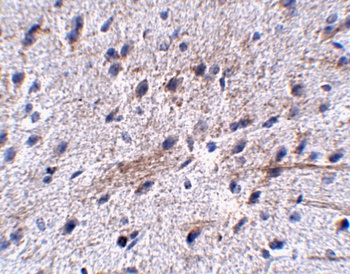 LRFN5 Antibody