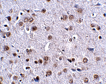 LRFN4 Antibody