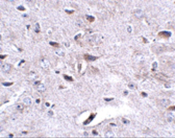 LRFN3 Antibody