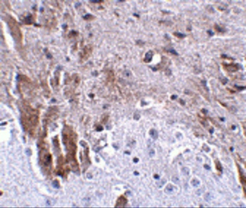 LRFN1 Antibody