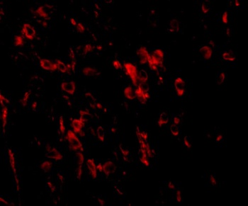 LRFN1 Antibody