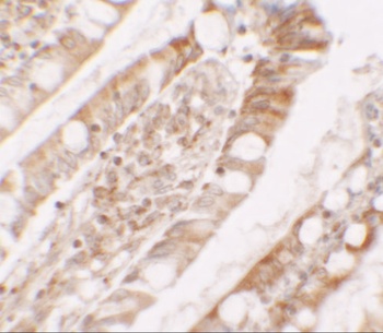 LPIN1 Antibody