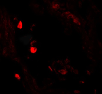 LNPEP Antibody