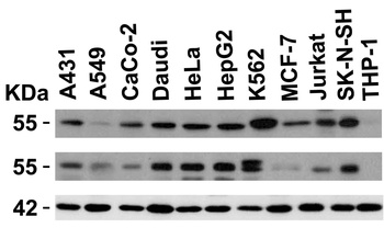 IRAK4 Antibody