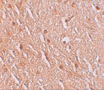 LMBRD1 Antibody