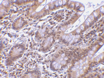 Livin Antibody