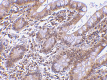 BIRC7 Antibody